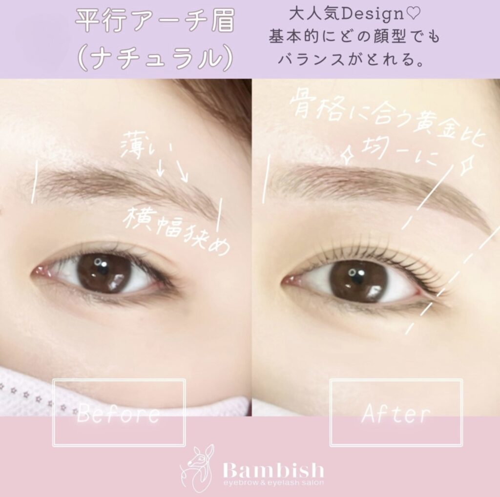 バンビッシュ　平行アーチ